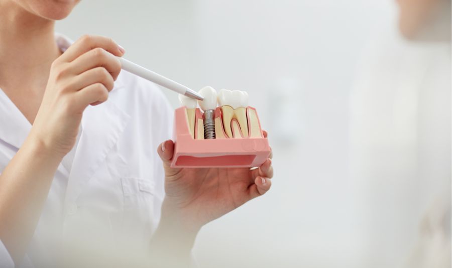 implante dental madrid